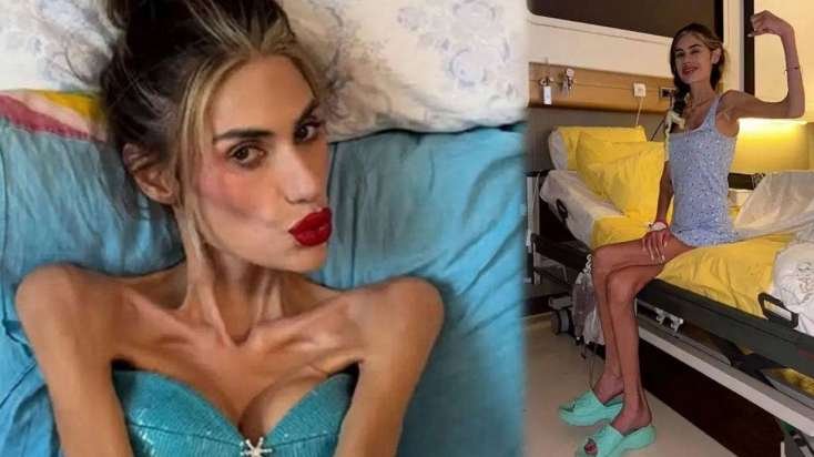 Çəkisi 23 kq-ya düşən Nihal vəfat etdi -