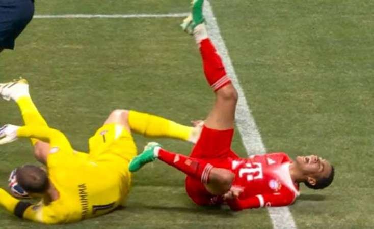 Məşhur futbolçunun oyun zamanı ayağı qırıldı -